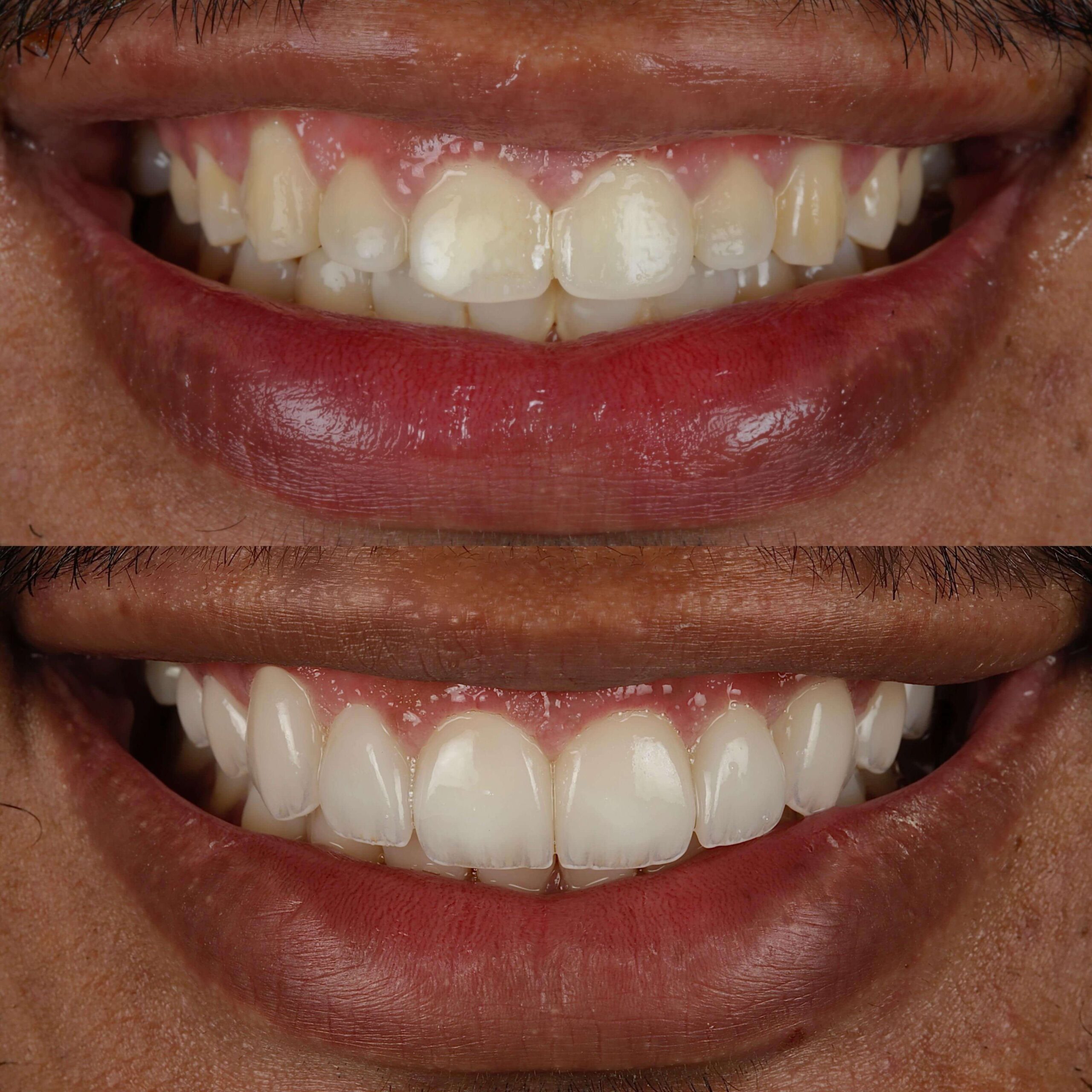 Resultado 01_Idealiza Odontologia