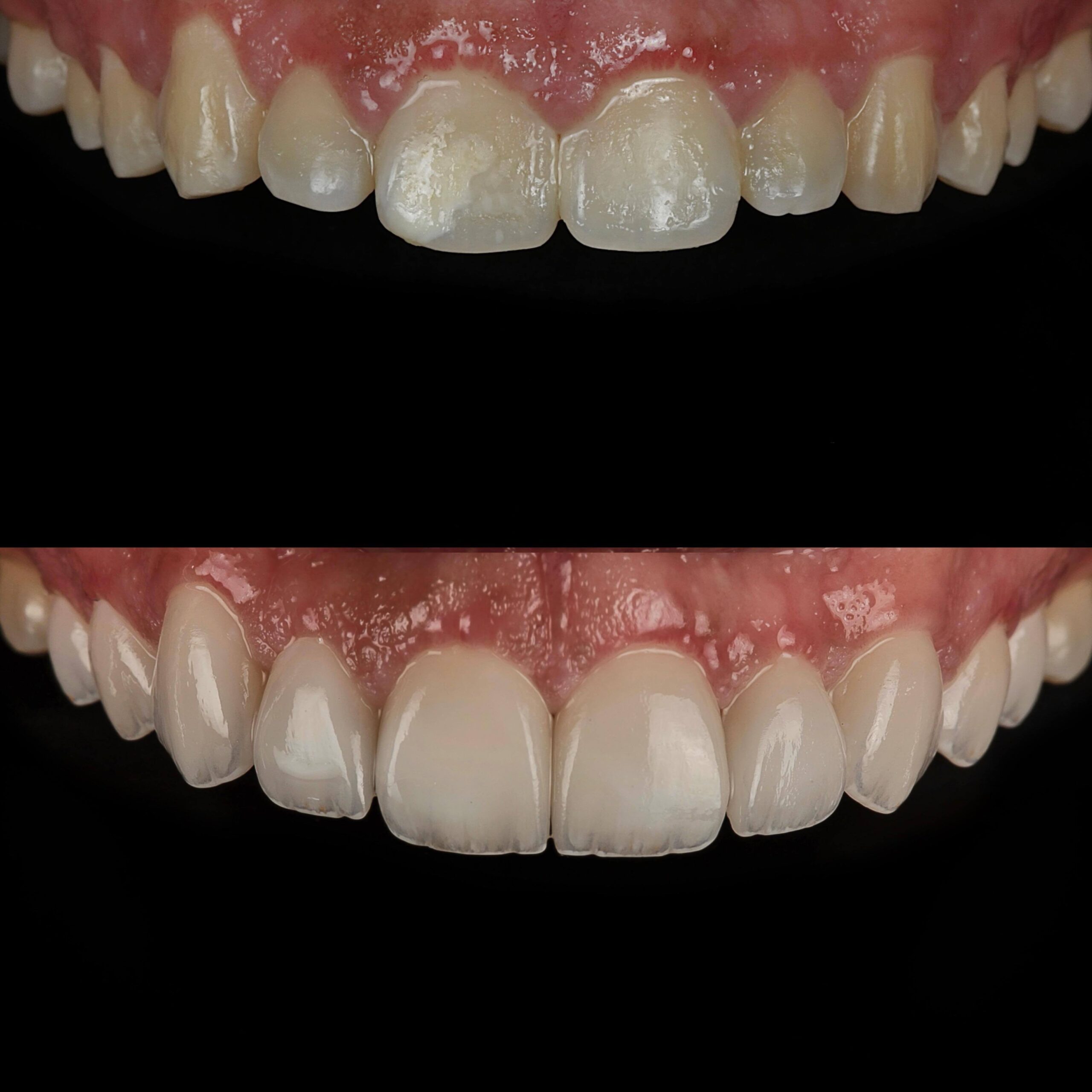 Resultado 02_Idealiza Odontologia