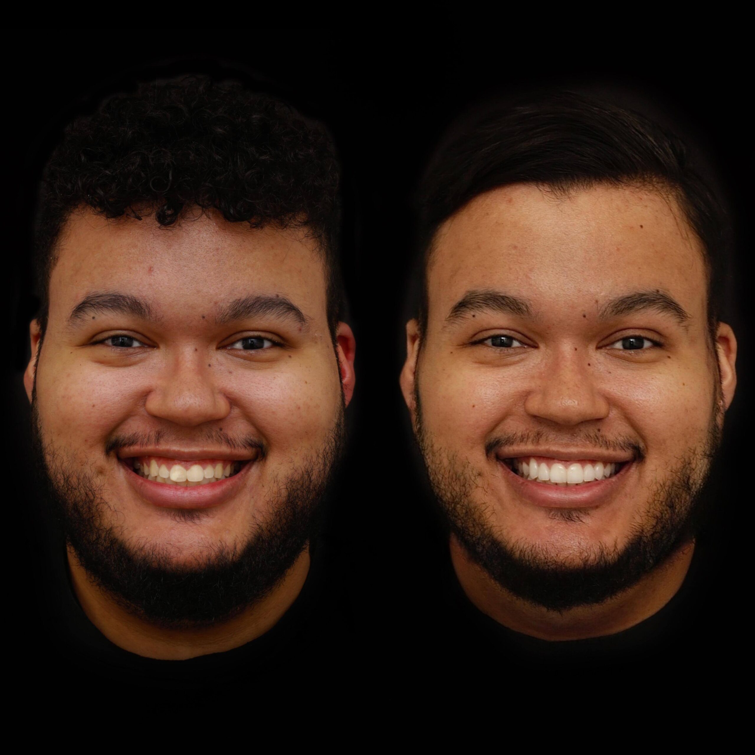 Resultado 03_Idealiza Odontologia