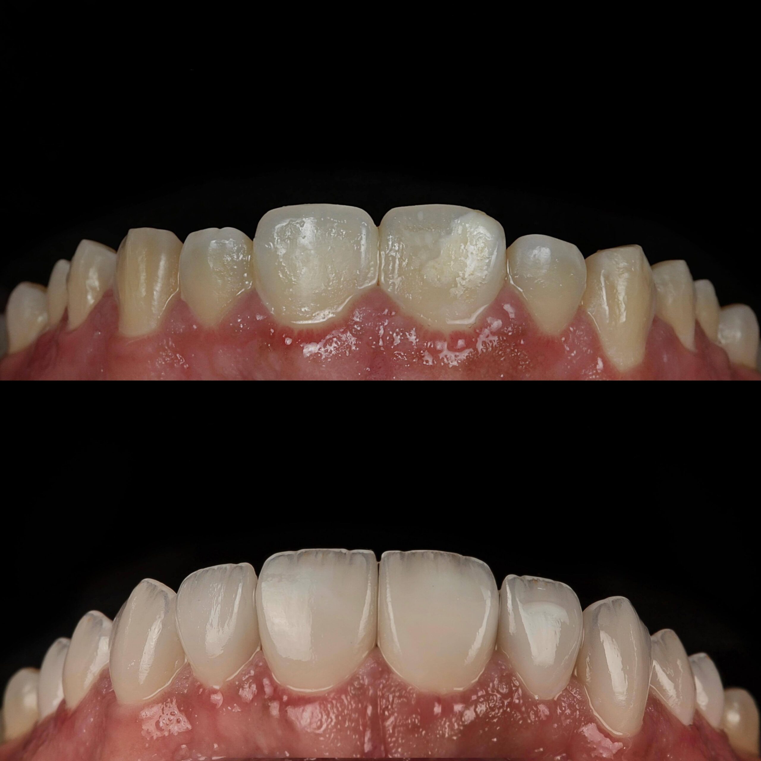Resultado 04_Idealiza Odontologia